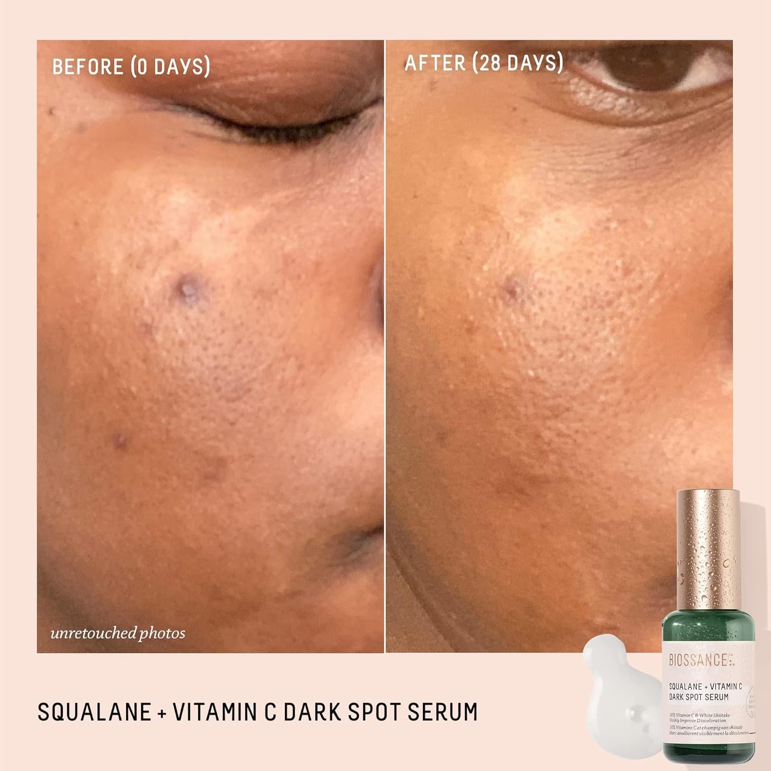 biossance squalane + vitamin c dark spot face serum – 10% vitamin c serum & white shiitake – hydrating, fragrance free, non irritating, for daily use for all skin types biossance squalane + vitamin c dark spot face serum – 10% vitamin c serum & white shiitake – hydrating, fragrance free, non irritating, for daily use for all skin types